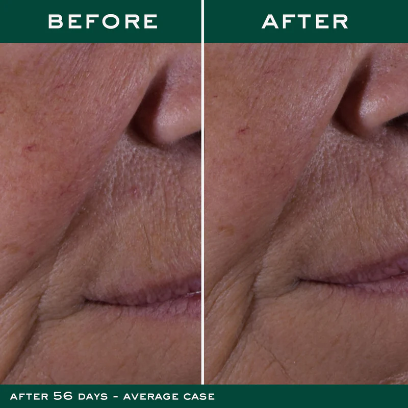 The Global Anti-Aging Cream