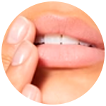 CUIDADO DE LABIOS